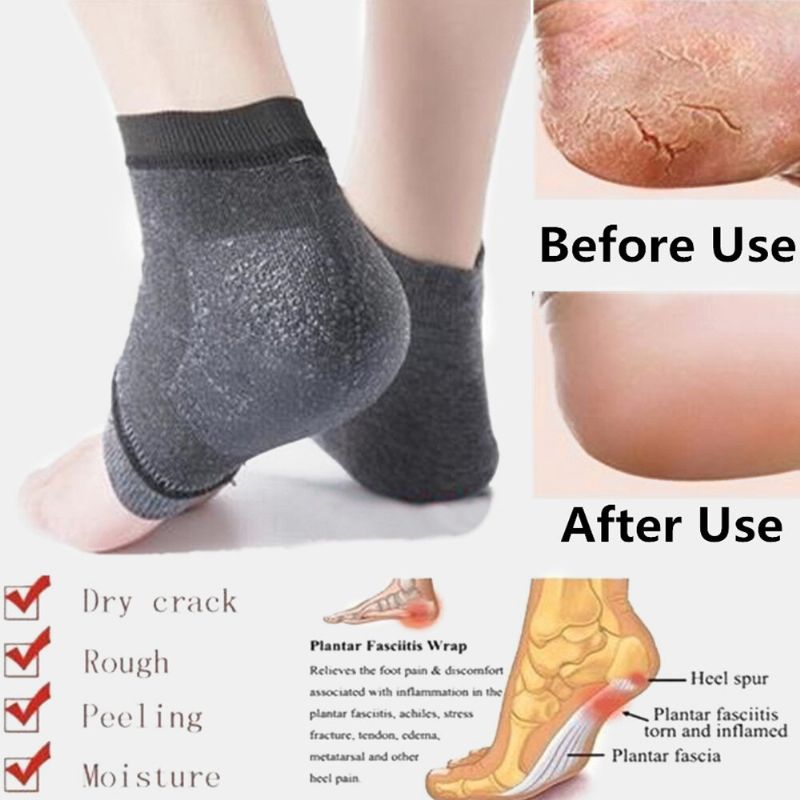 10 Paires De Chaussettes Anti-fissures En Silicone Pour Les Pieds